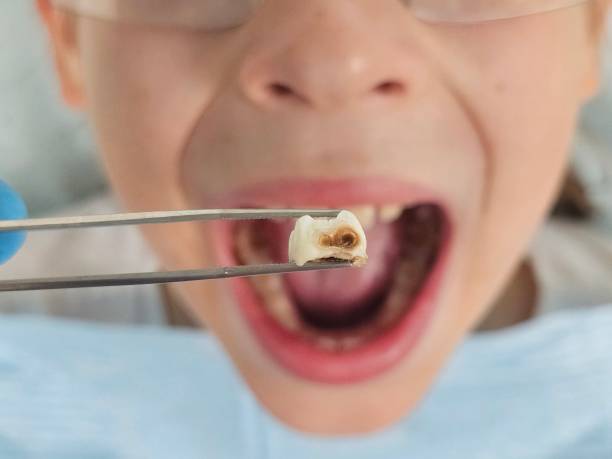 Best Emergency Gum Treatment in Camp Barrett, VA